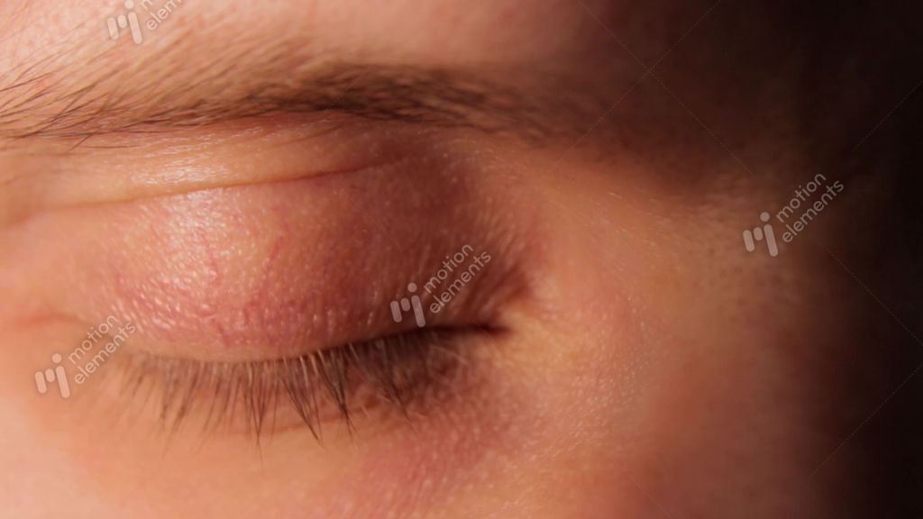 Sick Red Human Eye Stock video footage 11244296